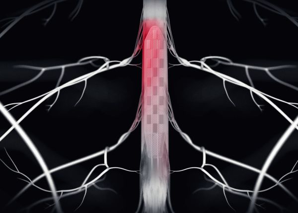 Photo : Emplacement de l'électrode dans la moëlle épinière © EPFL - Jimmy Ravier 