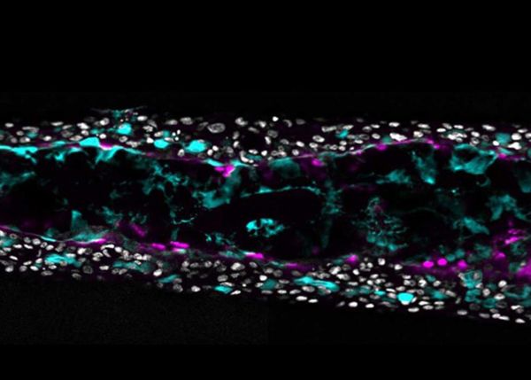 Photo : Image montrant les cellules ciliées (en magenta) et le mucus (en cyan) dans le modèle bronchioïde tubulaire développé par les chercheurs. Les noyaux de cellules sont en gris clair.